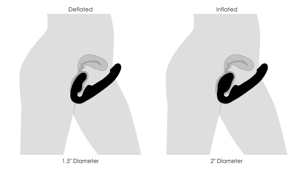 Ergo-Fit Twist Inflatable Vibrating Silicone Strapless Strap-on - Black - Image 7