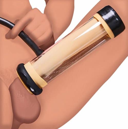 Large Replacement Cylinder Demo